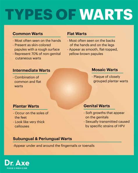 what causes hpv warts