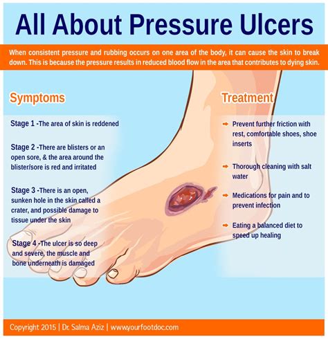 what causes pressure sores on feet