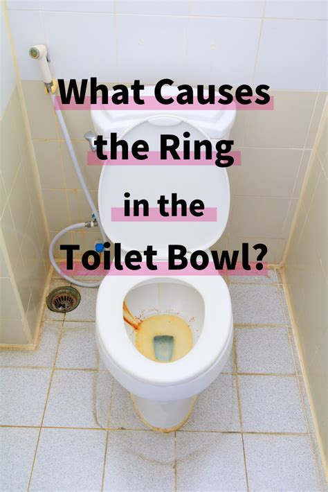 what causes toilet rings