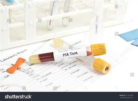 What Colour Bottle For Psa