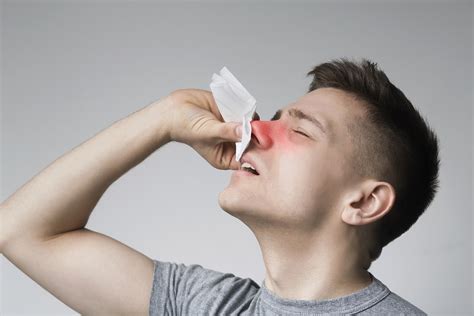 What Do For Nosebleed: Effective Steps to Stop and Prevent Epistaxis
