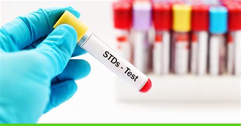 what do std blood tests test for