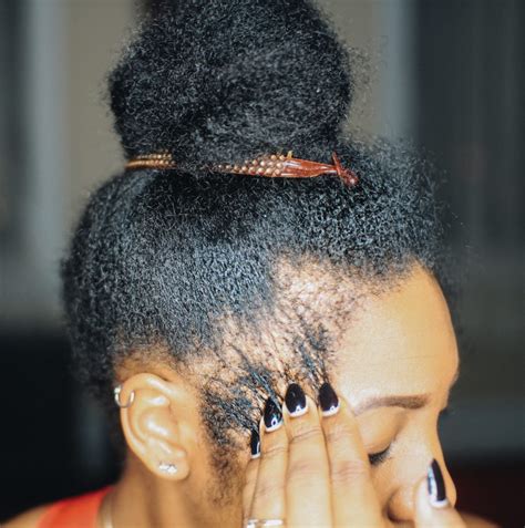 What Do Thinning Edges Look Like  A Comprehensive Guide
