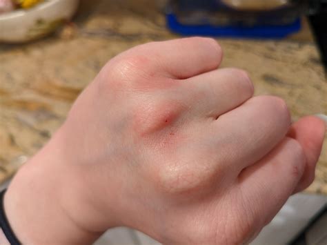 What Does A Baby Ball Python Bite Feel Like