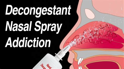 Relieve Congestion: What Does a Decongestant Do to Clear Your Airways?