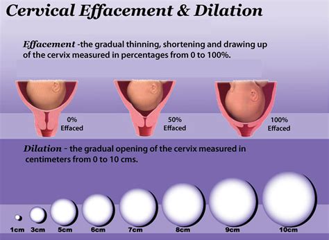 what does a fragile cervix mean