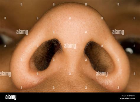 What Does A Normal Inside Nose Look Like