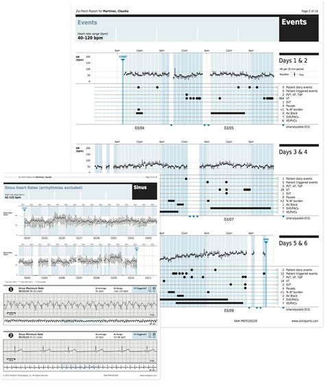 What Does A Zio Patch Report Look Like