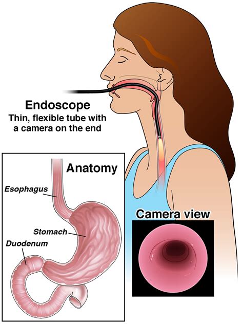 What Does An Endoscopy Procedure Show