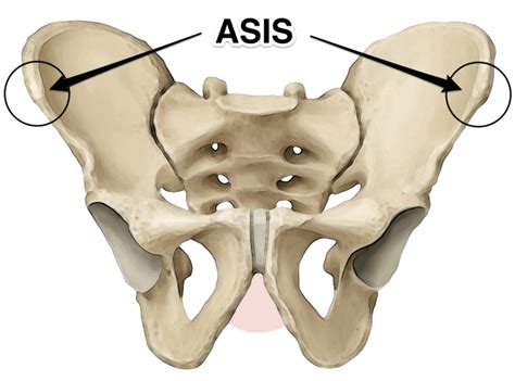 what does asis stand for in anatomy