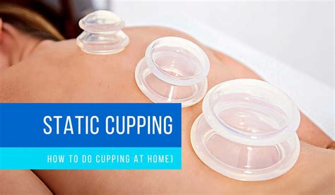 What Does Cupping A Prop Do