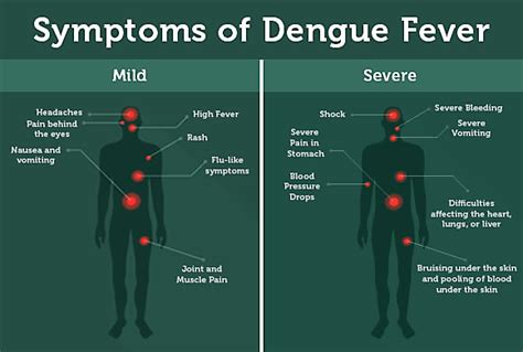 what does dengue fever look like