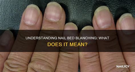 What Does Doing A Bed Mean