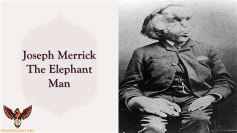 What Does Elephant Man Mean