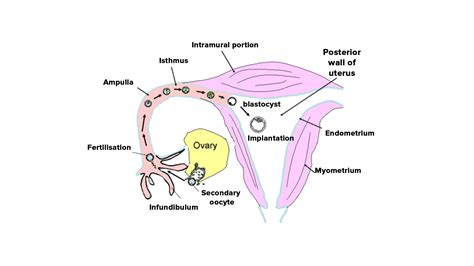 what does fulguration of oviducts mean
