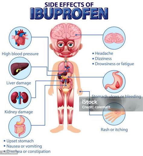 What Does Ibuprofen Hurt
