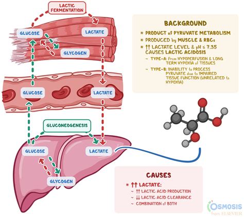 Lactic Acidosis Causes, Symptoms, Lactic Acidosis Treatment