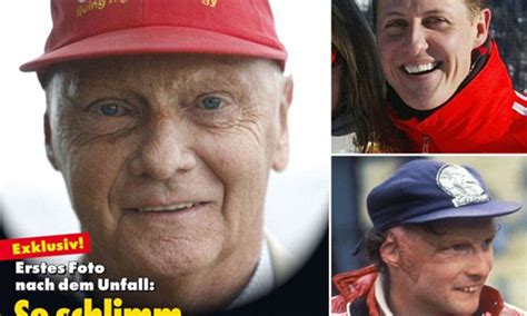 what does michael schumacher look like now