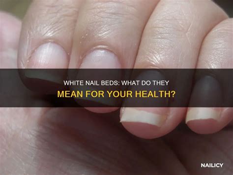What Does Nail Beds Mean