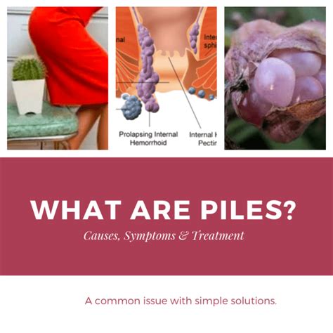 what does piles look like pictures