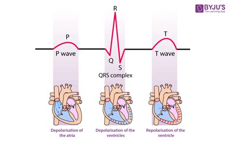 what does the qrs complex represent in an ecg tracing