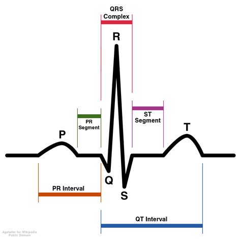 what does the qrs complex represent in the ecg wave tracing