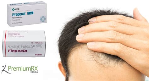 what dosage of finasteride for hair loss