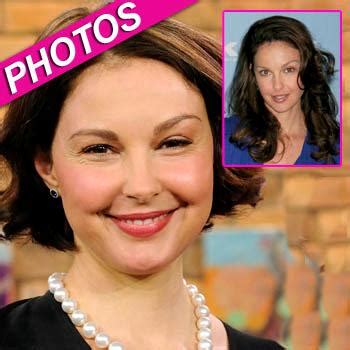 what happened to ashley judd face swollen