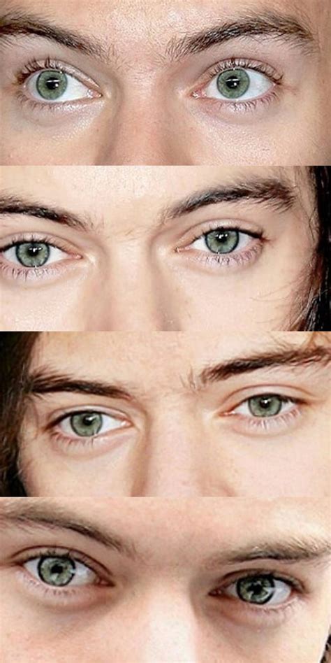 what happened to harry styles eye