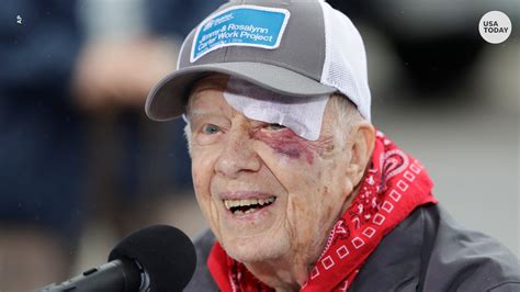 what happened to jimmy carter's health