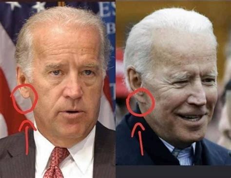 what happened to joe biden's right ear