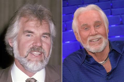 what happened to kenny rogers face