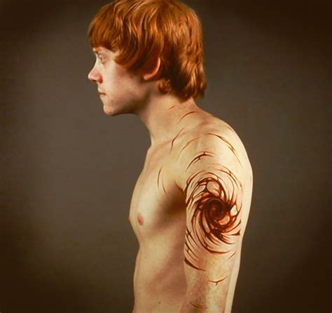 what happened to ron's arm