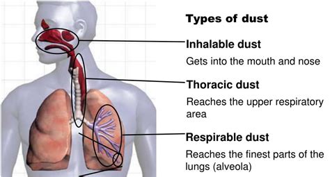 What Happens If You Inhale To Much Dust