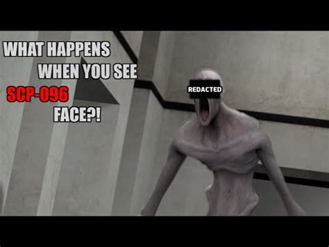 what happens if you look at scp 096 face