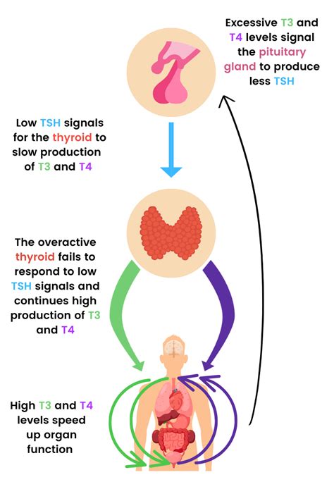 What Happens When Thyroid Levels Are Low