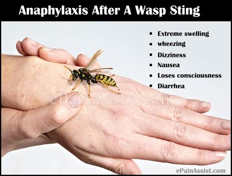 what happens when you get stung by a wasp