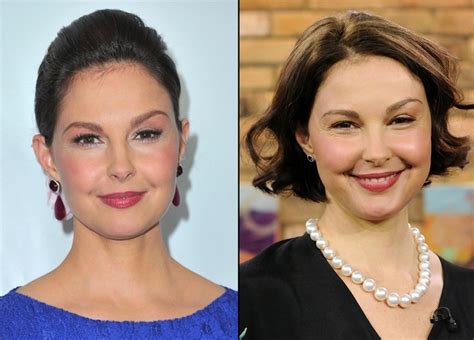 what has happened to ashley judd's face