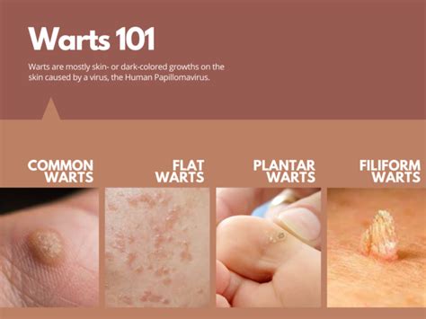 what hpv causes skin warts