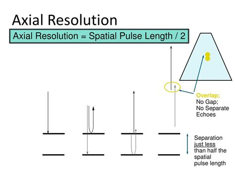 What Improves Axial Resolution