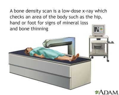 what is a bone density scan australia
