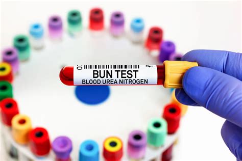 Understanding What is a BUN Test for Kidney Health