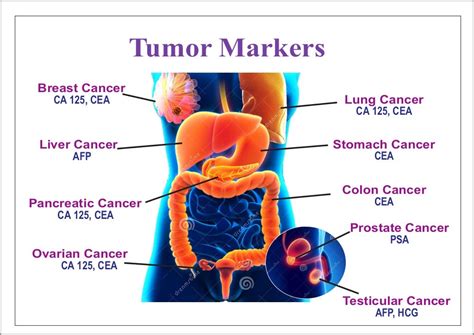 what is a cancer tumor marker