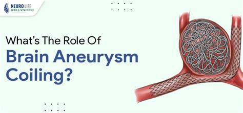 What Is A Coil In The Brain