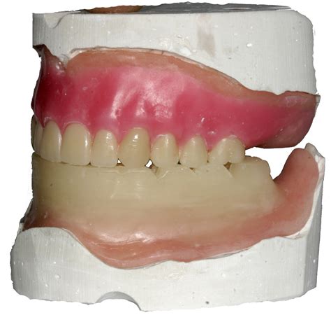 What Is A Denture Bite