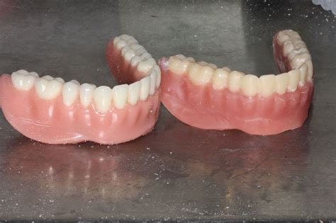 What Is A Duplicate Denture