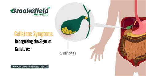 Understanding Digestive Health: What is a Gallstone and How Does it Form?