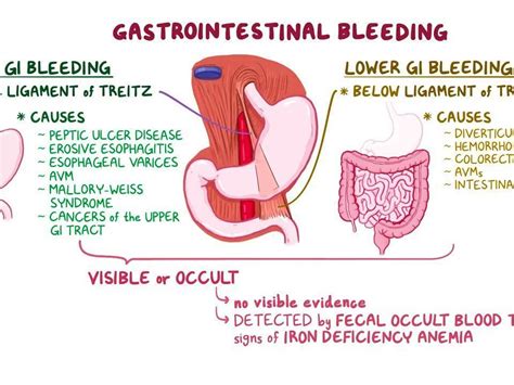 Understanding Gastrointestinal Health: What is a GI Bleed and What Are Its Risks?