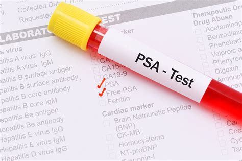 what is a good psa blood test result
