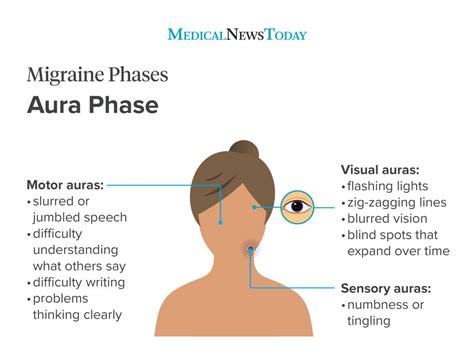 what is a headache with aura